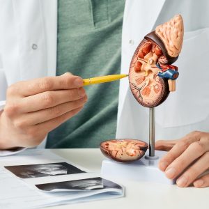 chronic kidney disease specialist