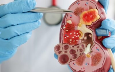 How Nephrologist Monitor Kidney Function