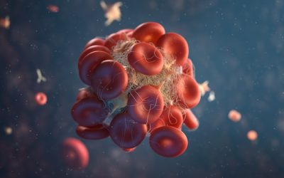 APPROVED Anemia in chronic kidney disease: why it happens and safe treatment options
