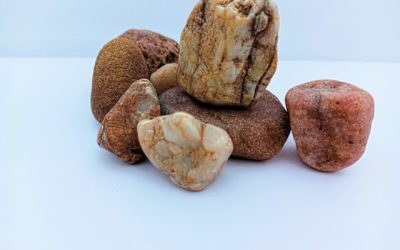 Kidney Stones: Why They Form, How to Prevent Them, and When to See a Specialist